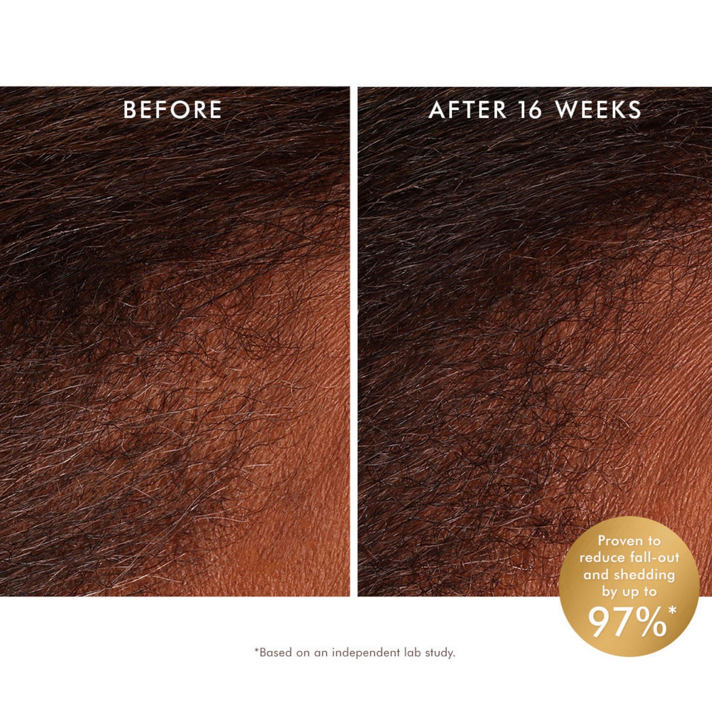 Moroccanoil Scalp Revitalizing Scalp Tonic สกัลป์ โทนิก บำรุงเส้นผมและหนังศรีษะ
